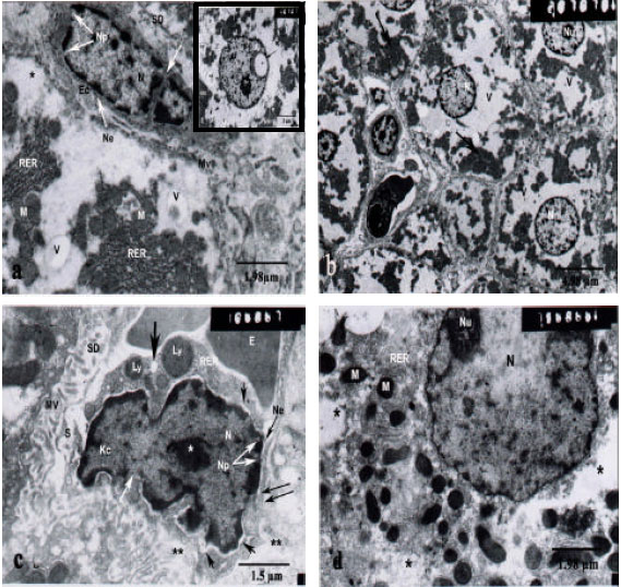 Image for - Silymarin Ameliorates Cisplatin-Induced Hepatotoxicity in Rats: Histopathological  and Ultrastructural Studies