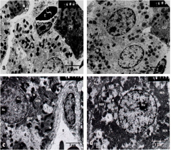 Image for - Silymarin Ameliorates Cisplatin-Induced Hepatotoxicity in Rats: Histopathological  and Ultrastructural Studies