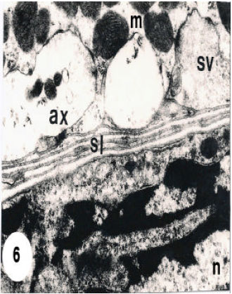 Image for - Ultrastructural Study of Muscles Fibers in Tick Hyalomma (Hyalomma) anatolicum anatolicum (Ixodoidea: Ixodidae)