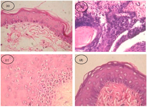 Image for - Chemopreventive Potential of 18β-glycyrrhetinic Acid: An Active Constituent of Liquorice, in 7,12-dimethylbenz(a)anthracene Induced Hamster Buccal Pouch Carcinogenesis
