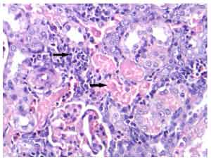 Image for - Nephrotoxicity and Oxidative Stress of Single Large Dose or Two Divided Doses of Gentamicin in Rats