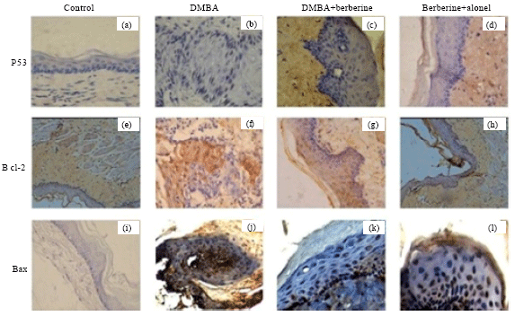 Image for - Protective Effect of Berberine on Expression Pattern of Apoptotic, Cell Proliferative, Inflammatory and Angiogenic Markers During 7,12-dimethylbenz(a)anthracene Induced Hamster Buccal Pouch Carcinogenesis