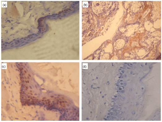 Image for - Protective Effect of Berberine on Expression Pattern of Apoptotic, Cell Proliferative, Inflammatory and Angiogenic Markers During 7,12-dimethylbenz(a)anthracene Induced Hamster Buccal Pouch Carcinogenesis