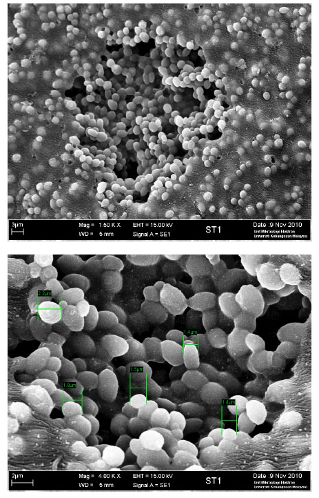 Image for - Immobilised Sarawak Malaysia Yeast Cells for Production of Bioethanol