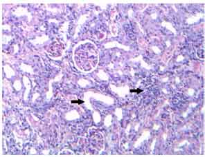 Image for - Nephrotoxicity and Oxidative Stress of Single Large Dose or Two Divided Doses of Gentamicin in Rats