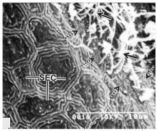 Image for - Distribution and Organization of Different Cells Lining the Olfactory Epithelium of the Indian Minor Carp, Labeo bata (Hamilton 1822): A Light and Scanning Electron Microscopic Analysis