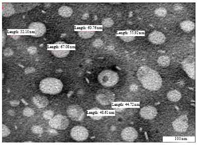 Image for - Characterization and Stability of Nanostructured Lipid Carriers as Drug Delivery System