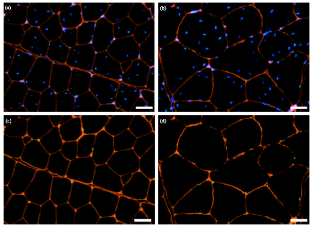 Image for - Effects of Sustanon on the Distribution of Satellite Cells and The Morphology of Skeletal Muscle Fibers During Maturation