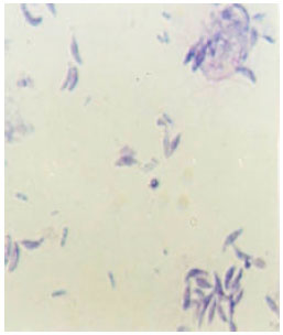 Image for - Zoonotic Chicken Toxoplasmosis in Some Egyptians Governorates