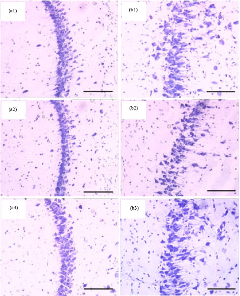 Image for - Curcuma comosa Prevents the Neuron Loss and Affects the Antioxidative Enzymes  in Hippocampus of Ethanol-treated Rats