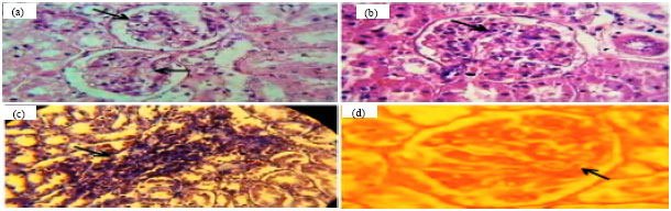 Image for - The Effect of Lactobacillus reuteri on Bone Morphogenetic Protein-7 and Beta Transforming Growth Factor Gene Expressions in Streptozotocin-induced Diabetic Rat’s Kidneys