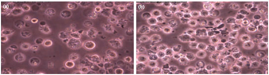 Image for - Cytotoxicity of Triphenyltin(IV) Methyl- and Ethylisopropyldithiocarbamate Compounds in Chronic Myelogenus Leukemia Cell Line (K-562)