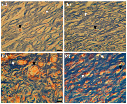 Image for - Histological Evaluation of the Healing Properties of Dead Sea Black Mud on Full-thickness Excision Cutaneous Wounds in BALB/c Mice