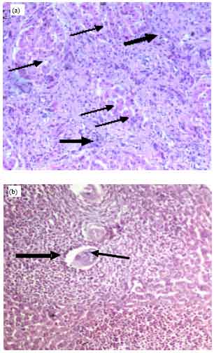 Image for - Overview on Cysteine Protease Inhibitors as Chemotherapy for Schistosomiasis  mansoni in Mice and also its Effect on the Parasitological and Immunological Profile