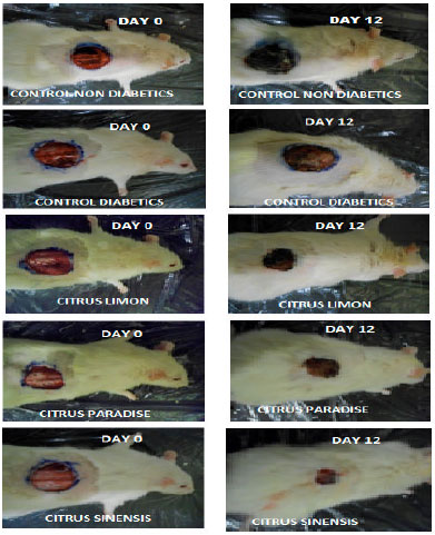 Image for - Oral Dose of Citrus Peel Extracts Promotes Wound Repair in Diabetic Rats