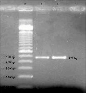 Image for - Multiplex PCR (Polymerase Chain Reaction) Assay for Detection of E. coli O157:H7, Salmonella sp., Vibrio cholerae and Vibrio parahaemolyticus in Spiked Shrimps (Penaeus monodon)
