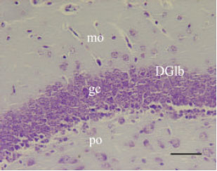 Image for - Effect of Maternal Morphine Sulfate Exposure on Neuronal Plasticity of Dentate Gyrus in Balb/c Mice Offspring