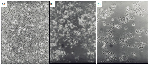 Image for - Cytotoxic Activity of Methanolic Extract of Mentha longifolia and Ocimum basilicum Against Human Breast Cancer