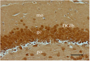 Image for - Effect of Maternal Morphine Sulfate Exposure on Neuronal Plasticity of Dentate Gyrus in Balb/c Mice Offspring