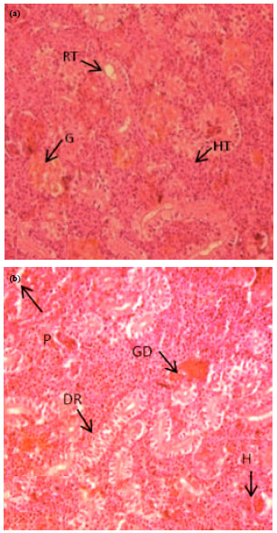 Image for - Histopathology and Bioaccumulation of Heavy Metals (Cr, Ni and Pb) in Fish (Channa striatus and Heteropneustes fossilis) Tissue: A Study for Toxicity and Ecological Impacts