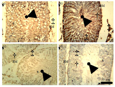 Image for - Role of Se+Zn in Regeneration (Ki-67) Following Pb Toxicity (p53andcad)  in the Germinal Epithelium of Adult Wistar Rats
