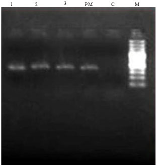 Image for - Isolation of Bovine Coronavirus (BCoV) in Vero Cell Line and its Confirmation by Direct FAT and RT-PCR