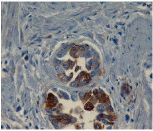 Image for - Role of Adhesion Molecules and Proliferation Hyperplasic, Pre Neoplastic and Neoplastic Lesions in Canine Prostate