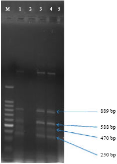 Image for - Multiplex PCR (Polymerase Chain Reaction) Assay for Detection of E. coli O157:H7, Salmonella sp., Vibrio cholerae and Vibrio parahaemolyticus in Spiked Shrimps (Penaeus monodon)