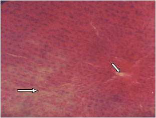 Image for - Alterations in the Liver Histology and Markers of Metabolic Syndrome Associated with Inflammation and Liver Damage in L-arginine Exposed Female Wistar Albino Rats