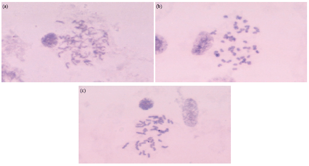 Image for - Chromosomal Studies and Quantitative Karyotypic Analysis of Rohu, Labeo rohita