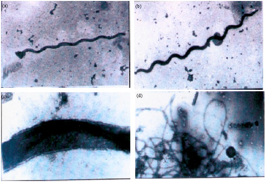 Image for - Culture of Borrelia persica and its Flagellar Antigen in vitro