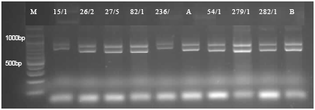 Image for - Restriction Analyze of Starch Synthesis Genes in Amaranth Mutant Lines