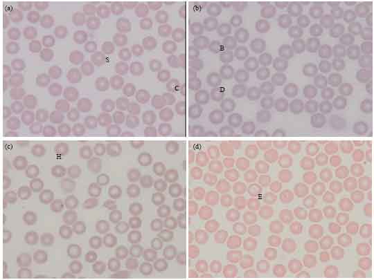 Image for - Reduced Red Blood Cell Membrane Damage in Streptozotocin-induced Diabetic Rats Supplemented With Roselle (UKMR-2) Calyx Extract