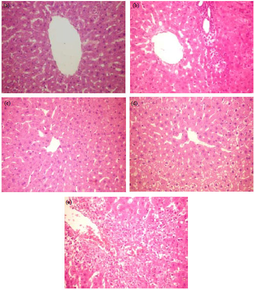 Image for - Hepatoprotective Potential of Astragalus kurdicus and Astragalus cinereus Extracts against Paracetamol Induced Liver Damage in Rats