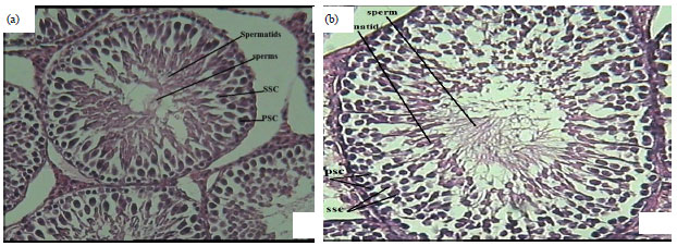Image for - Effects of Prepubertal Acute Immobilization Stress on Serum Kisspeptin Level and Testis Histology in Rats