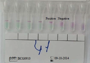 Image for - Evaluation of a New and Rapid Serologic Test for Detecting Brucellosis: Brucella Coombs Gel Test