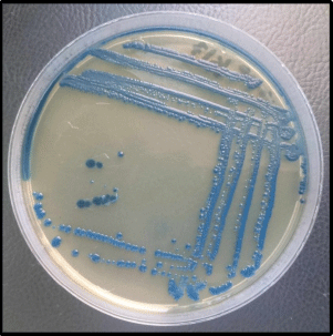 Image for - Phenotypic and Molecular Characterization of Multidrug Resistant Klebsiella pneumoniae Isolated from Different Clinical Sources in Al-Najaf Province-Iraq
