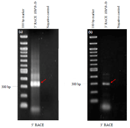Image for - Cloning and Expression Analysis of HbPR-1b and HbPR-3 in Hevea brasiliensis During Inoculation with Rigidoporus microporus