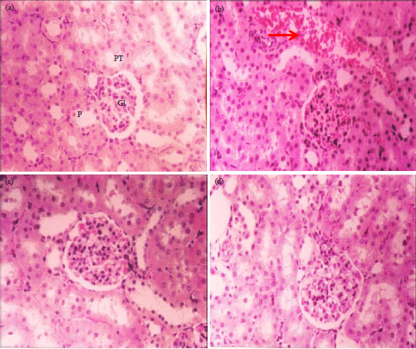 Image for - Ameliorative Effect of Arctium lappa Against Cadmium Genotoxicity and Histopathology in Kidney of Wistar Rat