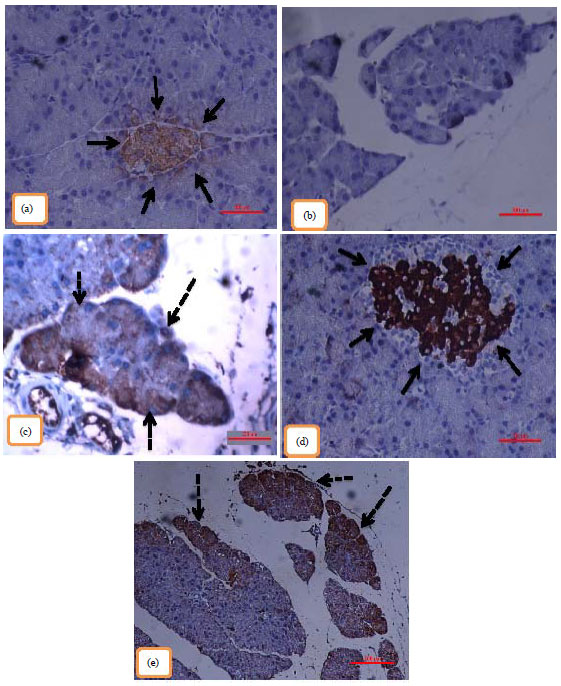Image for - Levels of Blood Glucose and Insulin Expression of Beta-cells in Streptozotocin-induced Diabetic Rats Treated with Ethanolic Extract of Artocarpus altilis Leaves and GABA