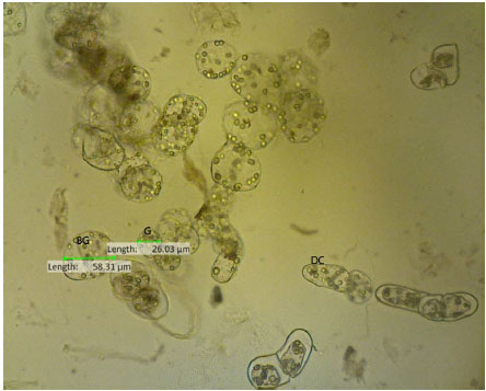 Image for - Flavonoid Production, Growth and Differentiation of Stelechocarpus burahol (Bl.) Hook. F. and Th. Cell Suspension Culture