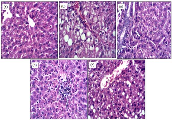 Image for - Comparative Study of Orange and its Main Bioactive Constituents as Remedy for Non-alcoholic Fatty Liver in Rats