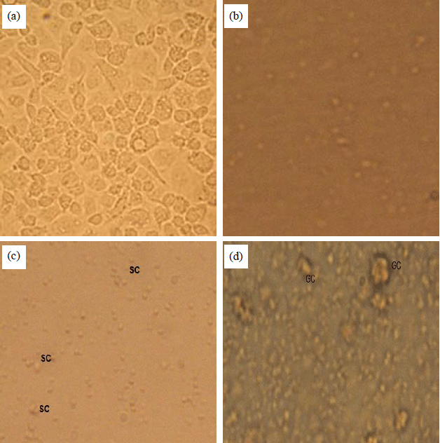 Image for - Molecular Characterization of Dengue E/NS1 Junction Genotype 2 Isolated From Saudi Patients, Jeddah Province