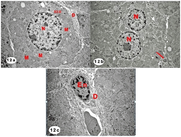 Image for - Possible Protective Role of Whey Protein on the Rat’s Liver Tissues Treated with Nandrolone decanoate