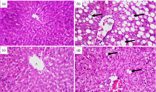 Image for - Preparation and Evaluation of Functional Foods for Prevention ofNon-alcoholic Fatty Liver Disease