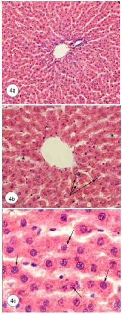 Image for - Possible Protective Role of Whey Protein on the Rat’s Liver Tissues Treated with Nandrolone decanoate
