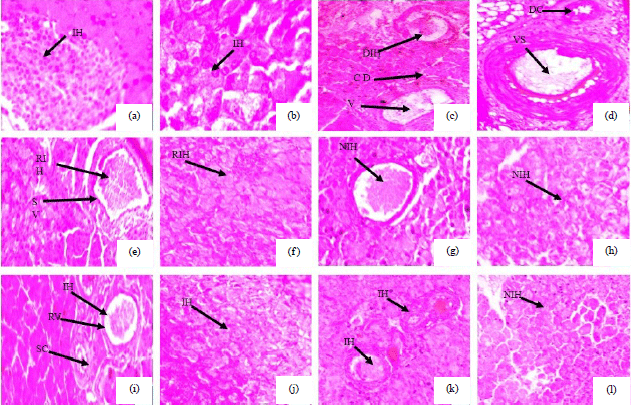 Image for - Protective Role of Melatonin in Streptozotocin Induced Pancreatic Damages in Diabetic Wistar Rat