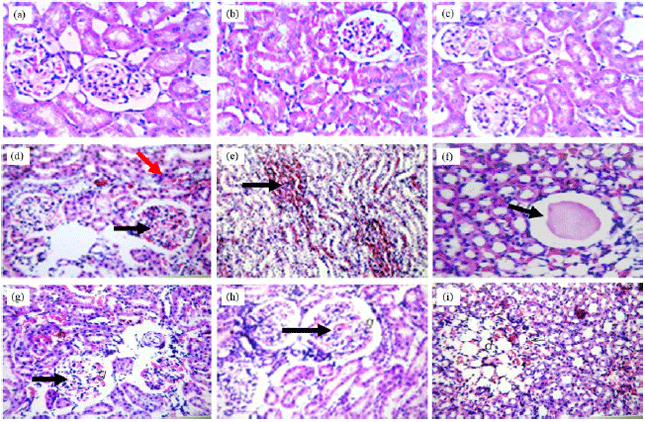 Image for - Potential Protective Role of Rutin and Alpha-lipoic Acid Against Cisplatin-induced Nephrotoxicity in Rats