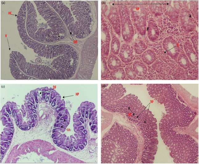 Image for - Lactobacillus rhamnosus Enhances the Immunological Antitumor Effect of 5-Fluorouracil against Colon Cancer