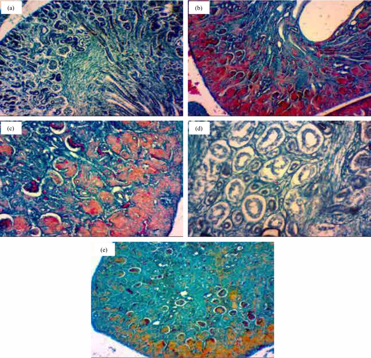 Image for - Effect of Transplanted Bone Marrow on Kidney Tissue of γ-Irradiated Pregnant Rats and Their Fetuses